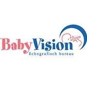 Baby Vision