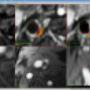Medis Medical Imaging Systems BV