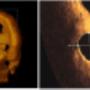 Medis Medical Imaging Systems BV