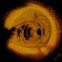 Medis Medical Imaging Systems BV
