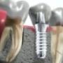 Ackdentoh Tandtechnisch Laboratorium