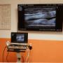 Echografie