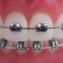 Henneman van Hees Orthodontisten