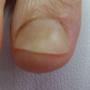 acryl nagel