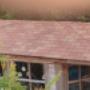 Shingles