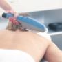 medcos-acne behandeling