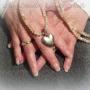Nagelbedverlening