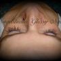wimperextensions
