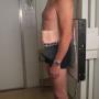 Lumbosacraal antero posterior