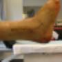 Fysiotherapie Haarlem Oost