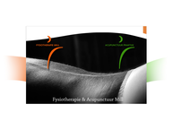 Website van Fysiotherapie Mill Marcel Peters 