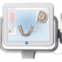 i-Tero scanner voor Invisalign