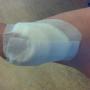 Anti druk techniek