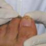 Podotherapie Mariëlle Heuer