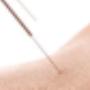 Acupunctuur Praktijk San Jiao