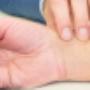 Acupunctuur Franeker