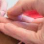 Acupunctuur Franeker