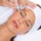 Microdermabrasoe