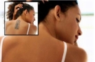 Tatoeage Verwijderen Hoorn