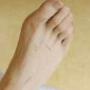 Fysiotherapie HD