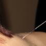 Vijf Elementen Acupunctuur en Chinese Kruiden