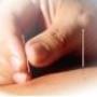 Fysiotherapie A Blom