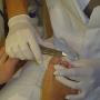 Behandeling nagels knippen