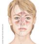 Rogier Trompert Medical Art