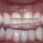 digitaal smile design