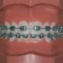 Orthodontistenpraktijk Dominicus Mattheeuws