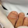 Nagelregulatie