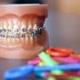 orthodontie