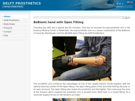 Delft Prosthetics B.v.