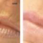 Perfect Skin Wormerveer Schoonheidssalon