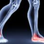 Triggerpointtherapie