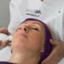 Radiofrequent behandeling