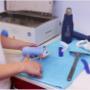 Spalken Bij HandTherapie