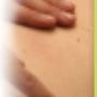 Fysiotherapiepraktijk Corpus Baarle Nassau