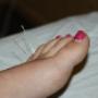 Schuurman, Fysiotherapie & Acupunctuur