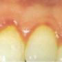 WestDent praktijk voor mondhygiëne
