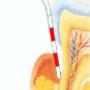 WestDent praktijk voor mondhygiëne