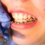 Orthodontist Roelofs