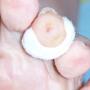 Pedicure Het Betere Voetenwerk