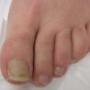 Pedicure Het Betere Voetenwerk