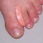 Pedicure Het Betere Voetenwerk