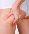 Cellulitis-massage