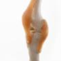 Osteopathie Armhoefse Praktijk Ben van Esch