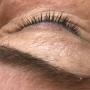 Zonder extensions
