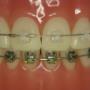 orthodontie