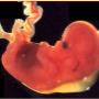 Verdikte nekplooi 13 wk